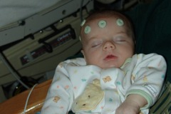 Alexander is ready for surgery!