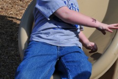Static electricity stinks...