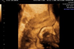 Kathryn resting (4D)